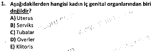ÇGL2005 Anne ve Çocuk Sağlığı çıkmış sınav sorusu 1