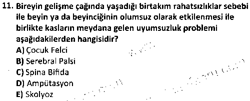 SPB3005 Engelliler İçin Beden Eğitimi ve Spor çıkmış sınav sorusu 3