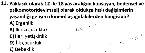 SOS1004 Gelişim Psikolojisi çıkmış sınav sorusu 3