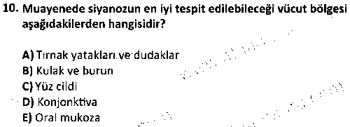 ACY1012 Fizyopatoloji çıkmış sınav sorusu 2