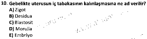 CGE1004 Çocuk Gelişimi 2 çıkmış sınav sorusu 2